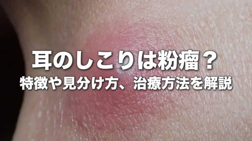 耳のしこりは粉瘤？特徴や見分け方、治療方法を詳しく解説