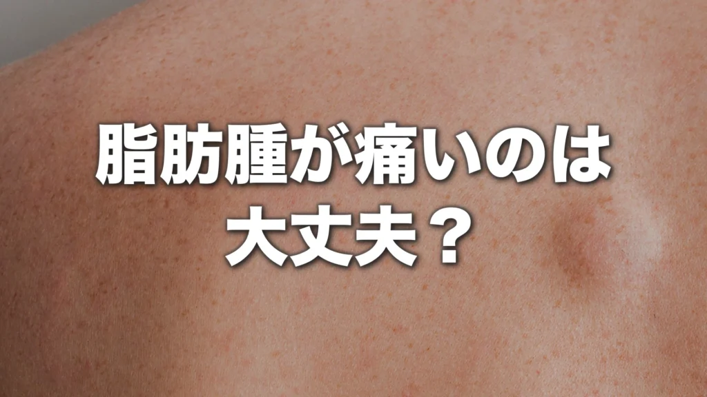 脂肪腫が痛いのは大丈夫？受診すべき症状と悪性との違いを解説