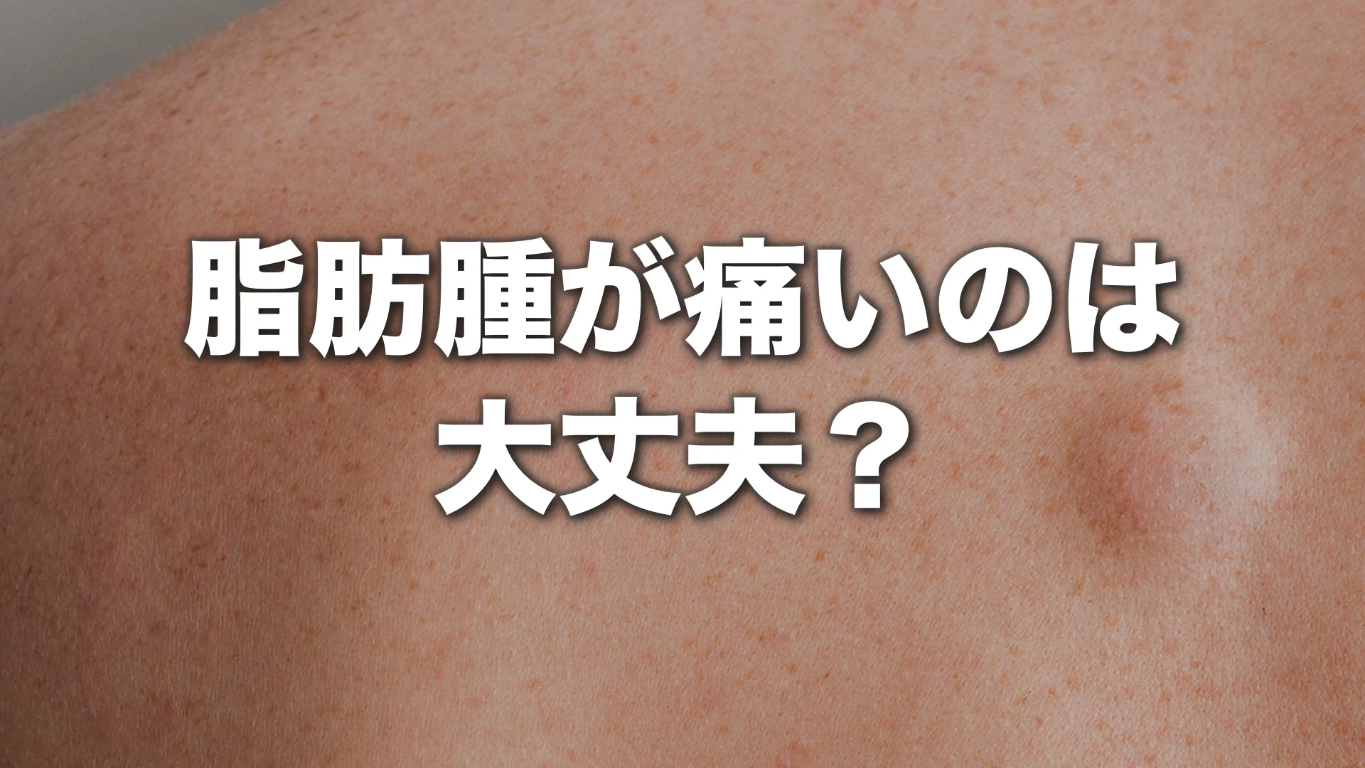 脂肪 腫 痛い