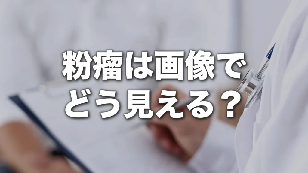 粉瘤は画像でどう見える？