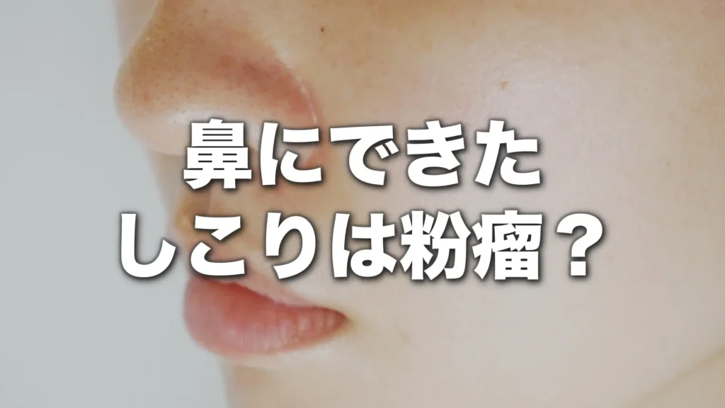 鼻にできたしこりは粉瘤？